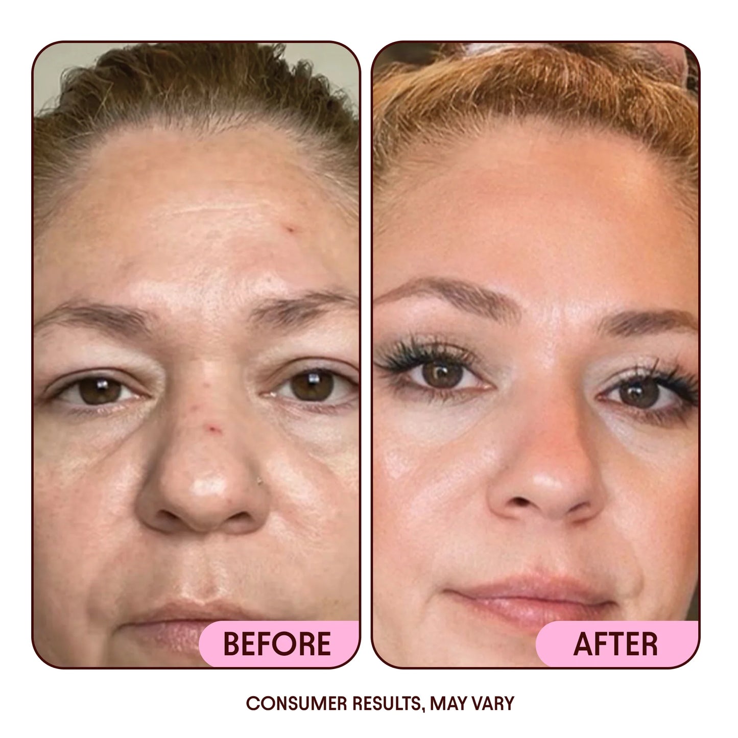 JIYU NAD+ Anti-Aging Moisturizing Cream (50ml)