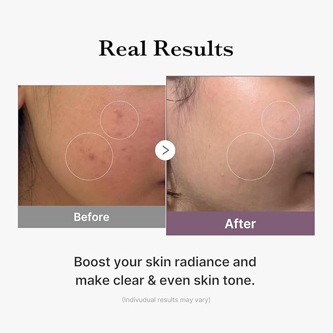 Medicube AGE-R Glutathione Glow Toner (140ml)