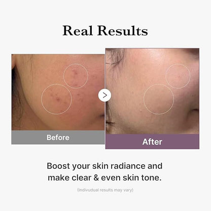 Medicube AGE-R Glutathione Glow Toner (140ml)