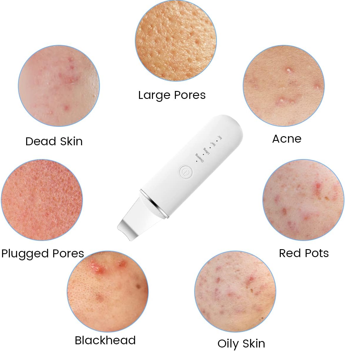Ultrasonic Skin Scrubber Pro™