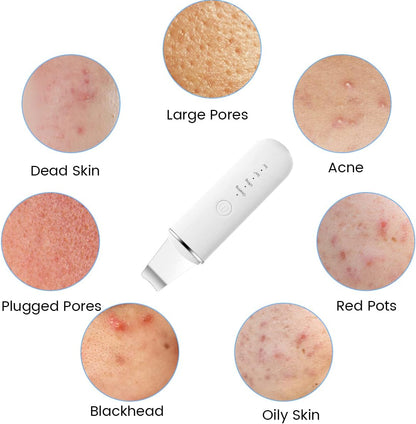 Ultrasonic Skin Scrubber Pro™