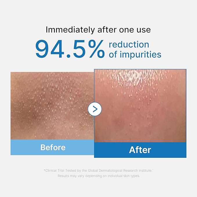 Medicube Zero Pore Blackhead Deep Cleansing Oil (205ml)