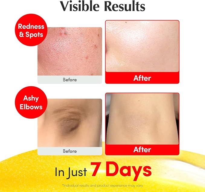 EQQUALBERRY Vitamin Illuminating Serum (30ml)