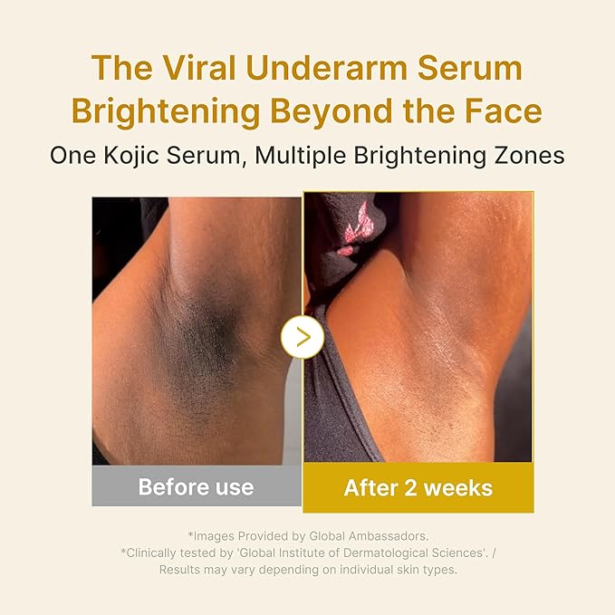 Medicube Kojic Acid Turmeric Serum (30ml)