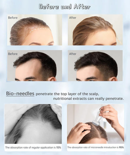 Dr. Pen BioNeedle™ Adjustable Micro-needling Derma Stamp
