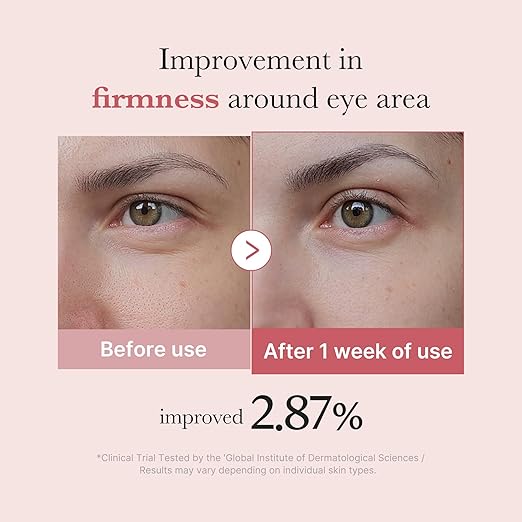 Medicube PDRN Pink Peptide Eye Cream (30ml)