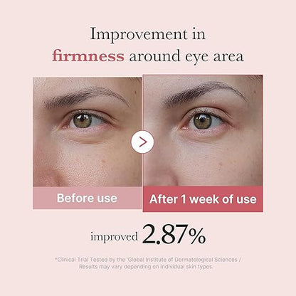 Medicube PDRN Pink Peptide Eye Cream (30ml)