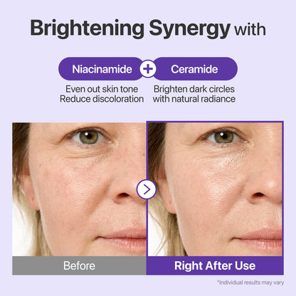 Numbuzin No.9 NAD+ PDRN Retinol Volumetox Eye Cream (20ml)