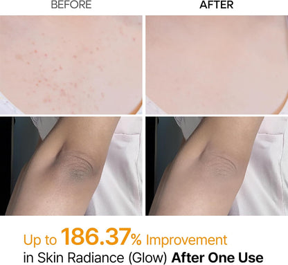 Dr. Melaxin Peel Shot Exfoliating Kojic Acid Turmeric Spray (200 ml)