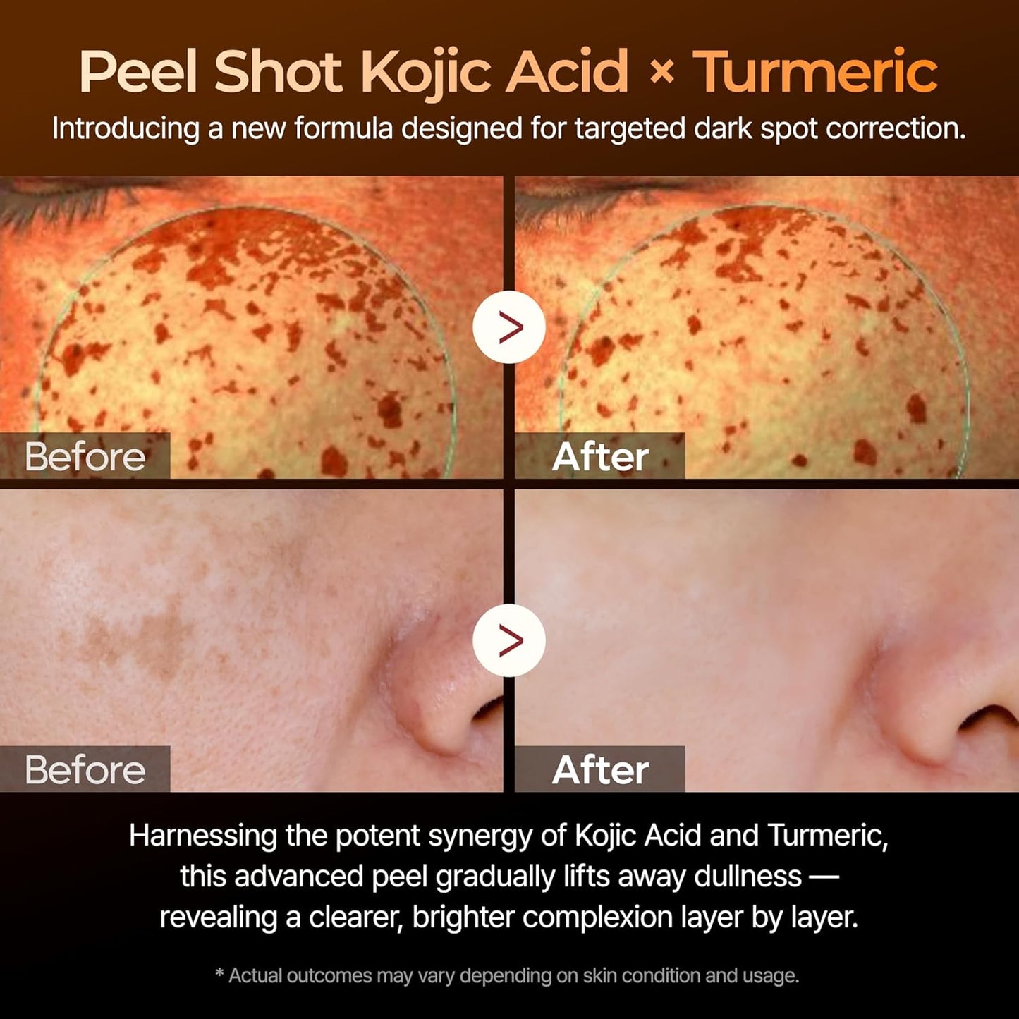 Dr.Melaxin - Peel Shot Exfoliating Serum with Kojic Acid and Turmeric 80ml
