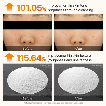 Dr.Melaxin - Peel Shot Exfoliating Serum with Kojic Acid and Turmeric 80ml