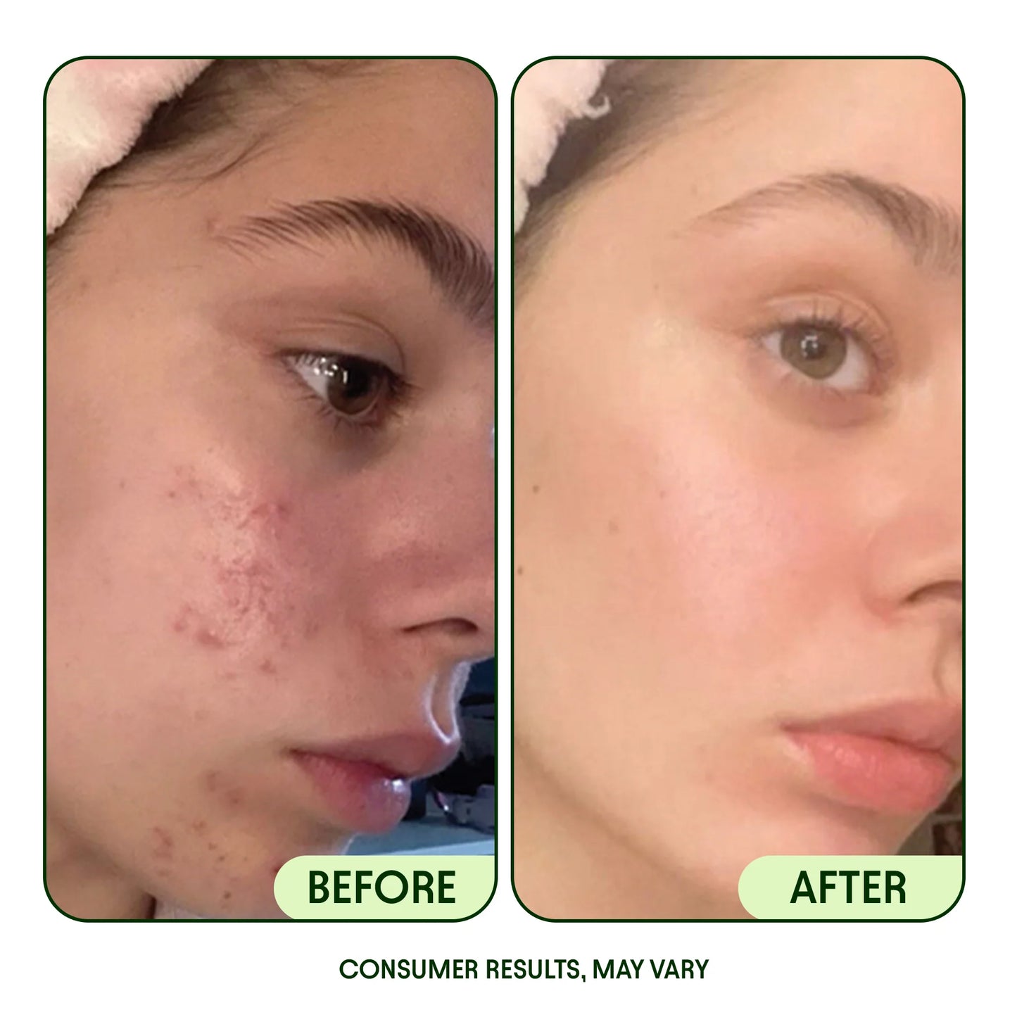 JIYU Renewal & Rejuvenation Toner Pads (100 Pads)