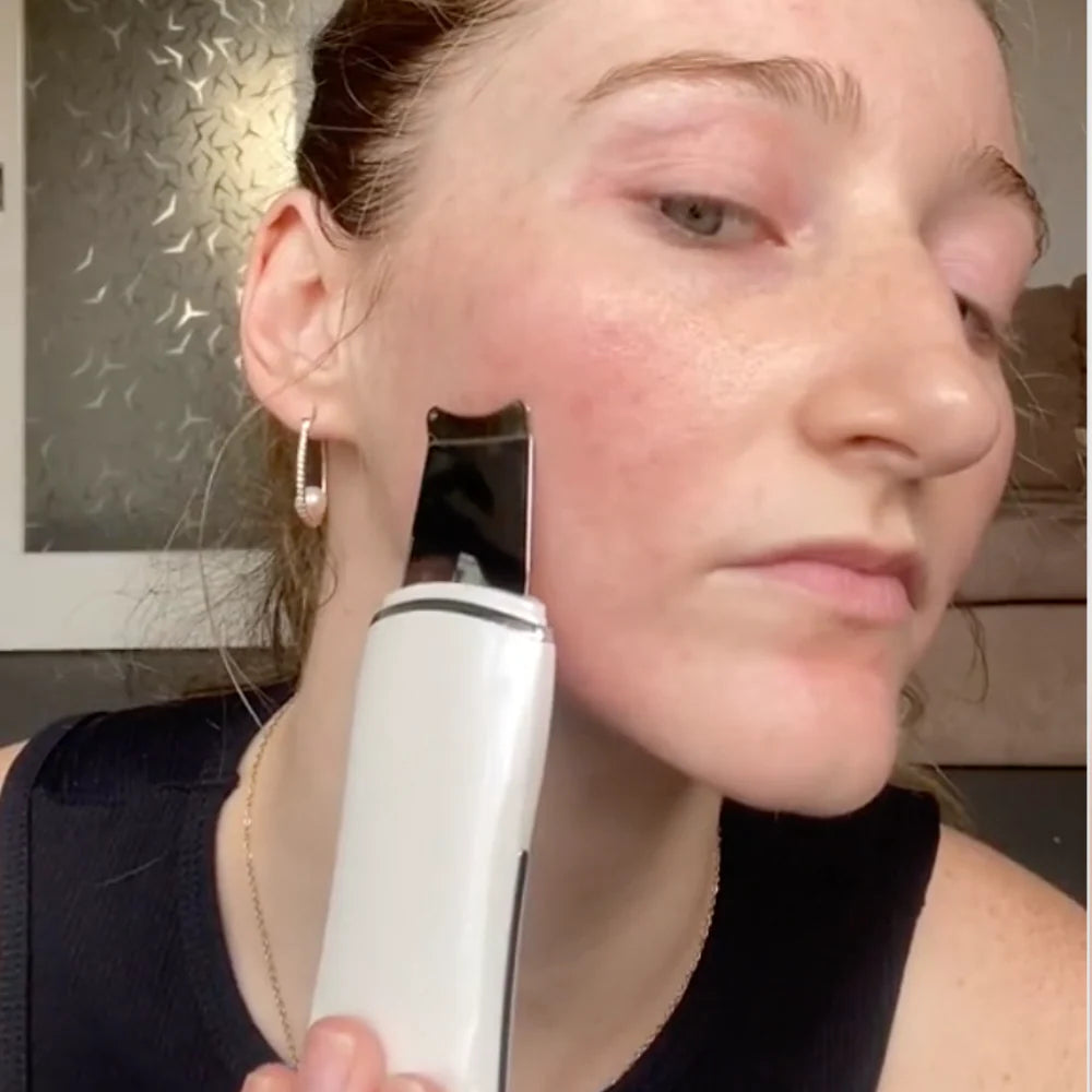 Ultrasonic Skin Scrubber Pro™